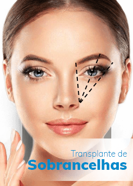 implante-de-sobrancelhas-002